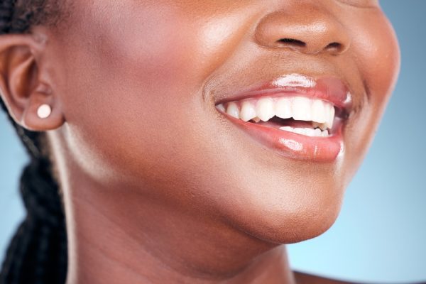 up close smile