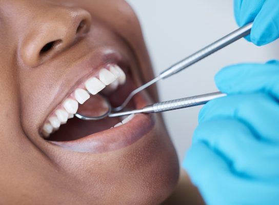 dental check up in progress
