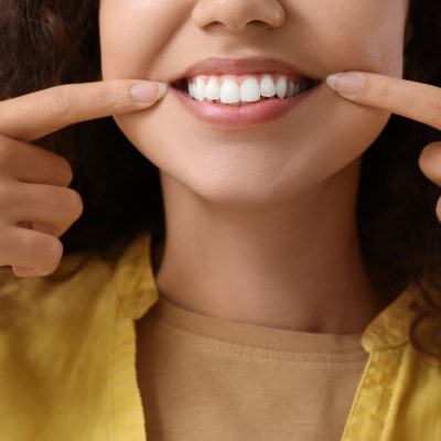 woman shows off smile