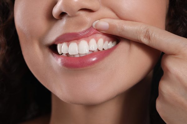 women shows healthy gums